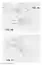Fig. 02 - METHOD AND DEVICE FOR INCREASING BONE DENSITY IN THE MOUTH
