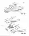 Fig. 04 - METHOD AND DEVICE FOR INCREASING BONE DENSITY IN THE MOUTH
