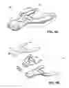 Fig. 07 - METHOD AND DEVICE FOR INCREASING BONE DENSITY IN THE MOUTH