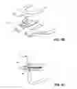 Fig. 09 - METHOD AND DEVICE FOR INCREASING BONE DENSITY IN THE MOUTH