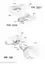 Fig. 16 - METHOD AND DEVICE FOR INCREASING BONE DENSITY IN THE MOUTH