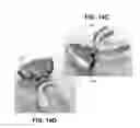 Fig. 20 - METHOD AND DEVICE FOR INCREASING BONE DENSITY IN THE MOUTH