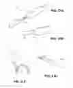 Fig. 27 - METHOD AND DEVICE FOR INCREASING BONE DENSITY IN THE MOUTH