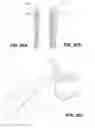 Fig. 32 - METHOD AND DEVICE FOR INCREASING BONE DENSITY IN THE MOUTH