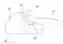 Fig. 01 - METHOD OF ASSEMBLING A DISTALIZER