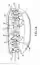 Fig. 02 - Cover for bracket of orthodontic appliance