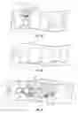 Fig. 04 - Method and apparatus for restoring improper morphology of the alveolar bone