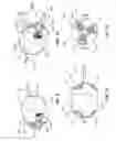 Fig. 06 - EMBOLIC FILTER BALLOON
