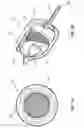 Fig. 07 - EMBOLIC FILTER BALLOON