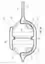 Fig. 08 - EMBOLIC FILTER BALLOON