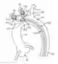Fig. 01 - Embolic protection device