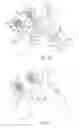 Fig. 08 - Embolic protection device