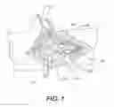 Fig. 02 - Device for tendon and ligament treatment