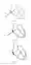 Fig. 13 - Artificial heart valve stent, artificial heart valve and implantation method
