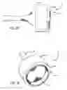 Fig. 15 - Stentless support structure