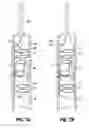 Fig. 07 - Vascular device for treating venous valve insufficiency