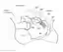 Fig. 01 - Sacroiliac joint implants and implantation methods