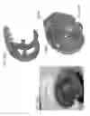 Fig. 167 - Patient-Adapted and Improved Articular Implants, Designs and Related Guide Tools