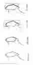 Fig. 239 - Patient-Adapted and Improved Articular Implants, Designs and Related Guide Tools