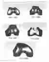 Fig. 262 - Patient-Adapted and Improved Articular Implants, Designs and Related Guide Tools