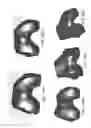 Fig. 263 - Patient-Adapted and Improved Articular Implants, Designs and Related Guide Tools