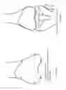 Fig. 37 - Patient-Adapted and Improved Articular Implants, Designs and Related Guide Tools