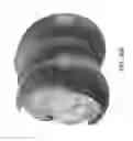 Fig. 48 - Patient-Adapted and Improved Articular Implants, Designs and Related Guide Tools