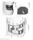 Fig. 64 - Patient-Adapted and Improved Articular Implants, Designs and Related Guide Tools