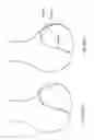 Fig. 75 - Patient-Adapted and Improved Articular Implants, Designs and Related Guide Tools