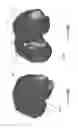 Fig. 82 - Patient-Adapted and Improved Articular Implants, Designs and Related Guide Tools
