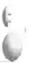 Fig. 86 - Patient-Adapted and Improved Articular Implants, Designs and Related Guide Tools