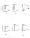 Fig. 99 - Patient-Adapted and Improved Articular Implants, Designs and Related Guide Tools