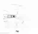 Fig. 02 - Expandable intervertebral implant and related methods