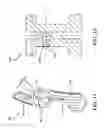 Fig. 07 - Spine surgery method and instrumentation