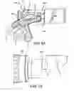 Fig. 49 - Spine surgery method and instrumentation