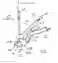 Fig. 03 - Locking grip orthopedic implant extraction tool