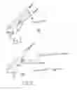 Fig. 08 - Locking grip orthopedic implant extraction tool