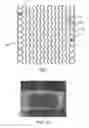 Fig. 02 - BIODEGRADABLE ENDOPROSTHESES AND METHODS OF THEIR FABRICATION