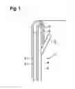 Fig. 02 - Double stent