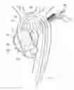 Fig. 01 - MEDICAL DEVICE WITH INDUCTION TRIGGERED ANCHORS AND SYSTEM FOR DEPLOYMENT OF THE SAME