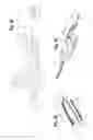 Fig. 22 - Deployment handle for a pre-loaded iliac prosthesis delivery device