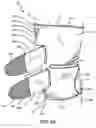 Fig. 08 - Knee brace