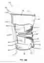 Fig. 09 - Knee brace