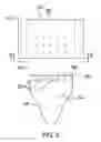 Fig. 03 - Support Garment Assembly