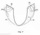 Fig. 07 - Support Garment Assembly