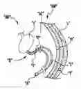 Fig. 01 - Method and apparatus for accessing matter disposed within an internal body vessel