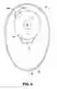 Fig. 06 - Ostomy pouch appliance