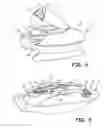 Fig. 04 - Hyperthermic conditioning capsule
