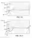 Fig. 08 - METHODS AND SYSTEMS FOR OCT GUIDED GLAUCOMA SURGERY