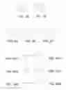 Fig. 02 - Intraocular delivery devices and methods therefor